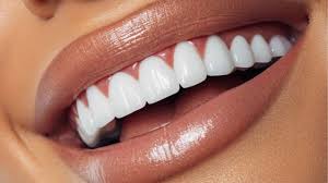 Odontologia Estética